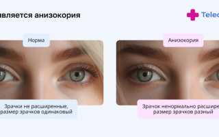 Особенности врождённой и приобретённой анизокории: анализ и сравнение