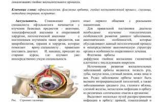 Особенности лечения флегмоны глаза: важные аспекты и рекомендации