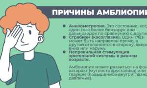 Причины амблиопии, симптоматика, методы лечения и профилактики заболевания глаз