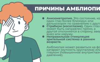 Причины амблиопии, симптоматика, методы лечения и профилактики заболевания глаз