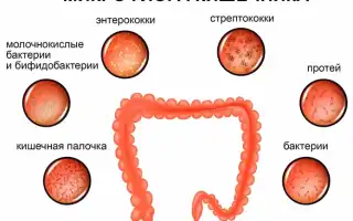 Дисбактериоз у мужчин в урологии симптомы и лечение