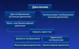 Причины двоения в глазах и их последствия