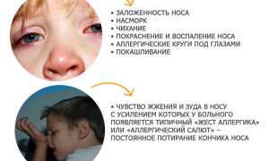Почему у ребёнка слезятся глаза и насморк: возможные причины и советы