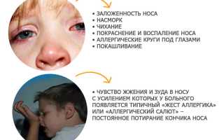 Почему у ребёнка слезятся глаза и насморк: возможные причины и советы