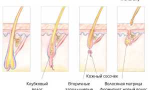 Вырастут ли ресницы после выпадения и как это происходит