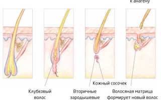 Вырастут ли ресницы после выпадения и как это происходит