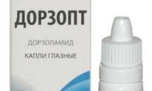 Применение аналогов Дорзопта при развитии глаукомы: важные аспекты и рекомендации
