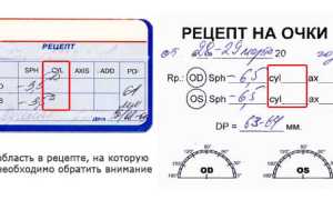 OD OS – обозначения для какого глаза в рецепте от офтальмолога и их значение