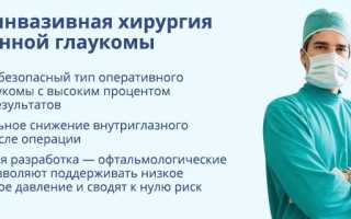 Всё, что необходимо знать об операции при глаукоме для пациентов