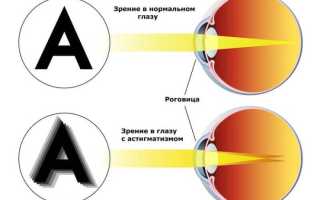 Служат ли в армии с астигматизмом: важные аспекты и рекомендации